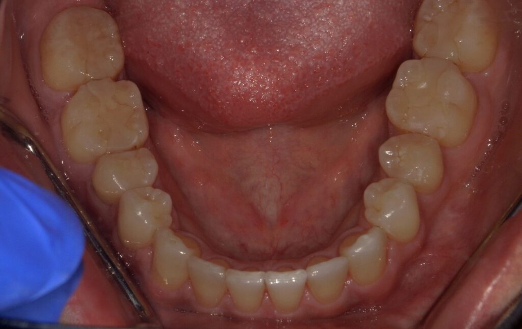 teeth before operation
